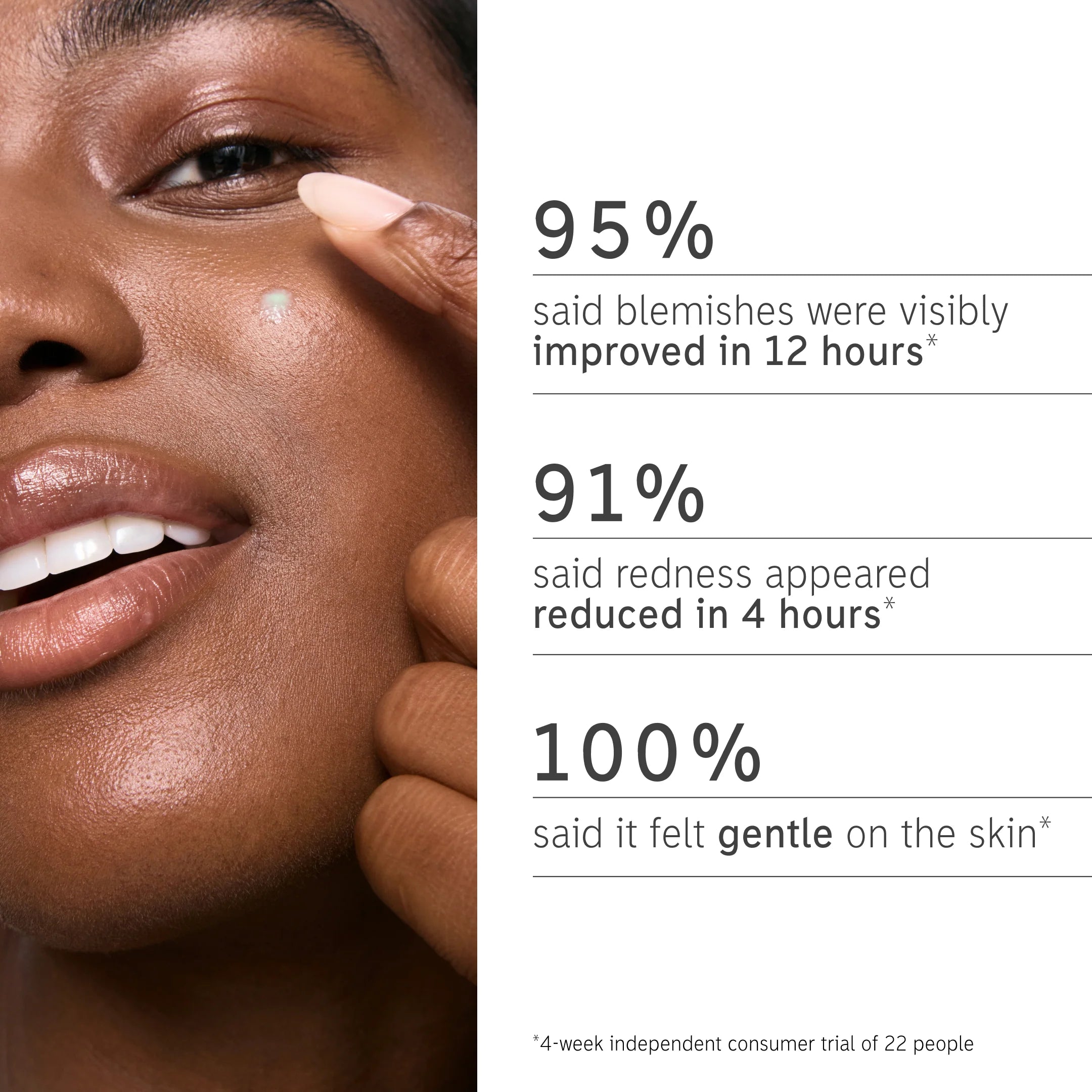 Woman applying Inkey List Succinic Acid Treatment with statistics showing 95% saw improved blemishes in 12 hours and 91% reduced redness in 4 hours.