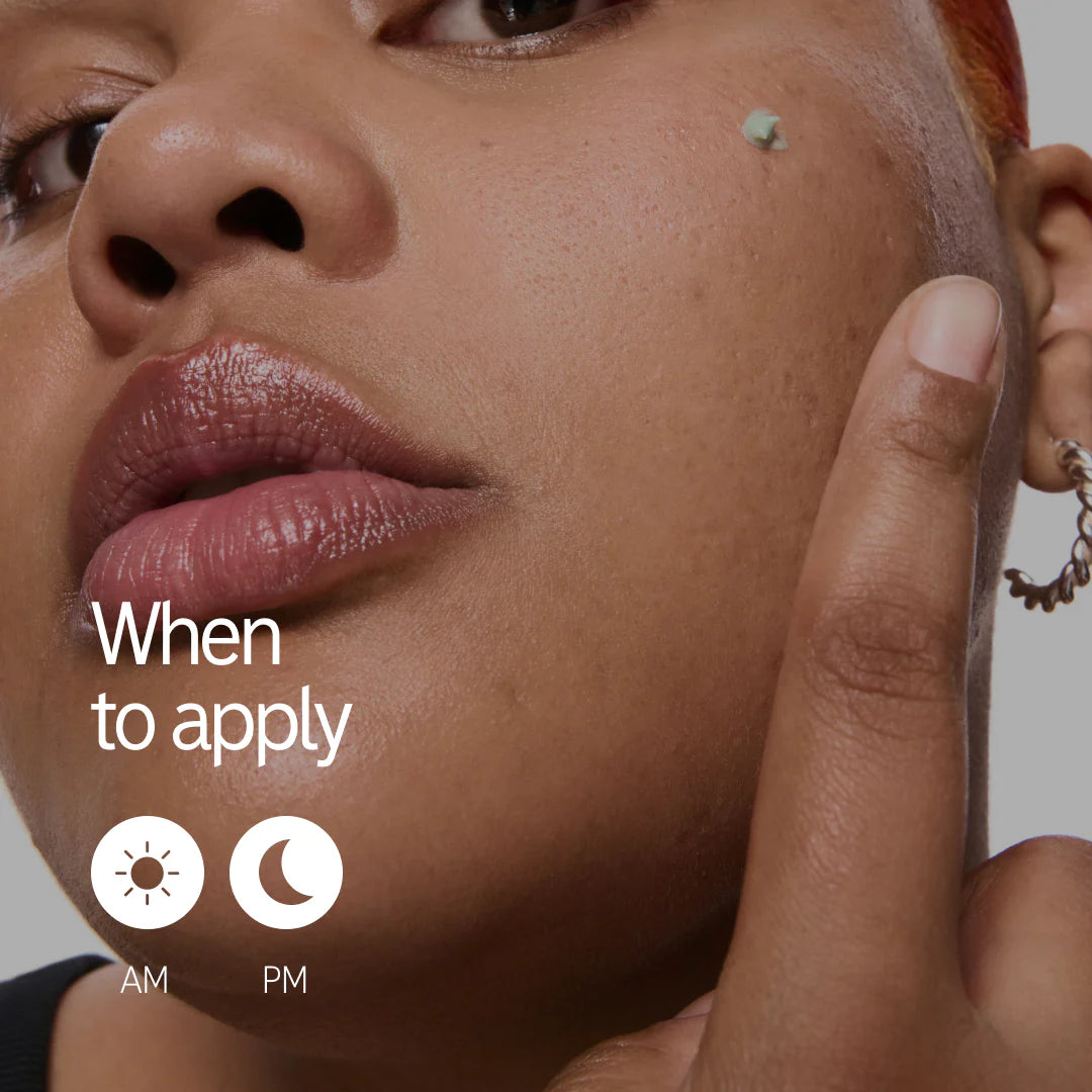 Woman applying Inkey List Succinic Acid Treatment to cheek with icons indicating AM and PM usage for daily acne care.