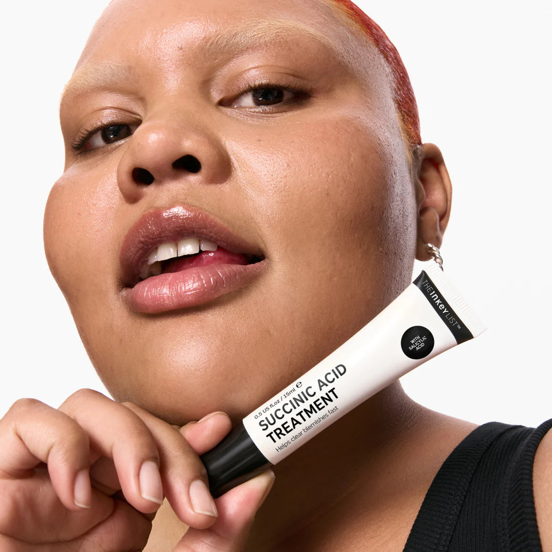 Model holding Inkey List Succinic Acid Treatment tube, showcasing product size and packaging for targeted blemish treatment.