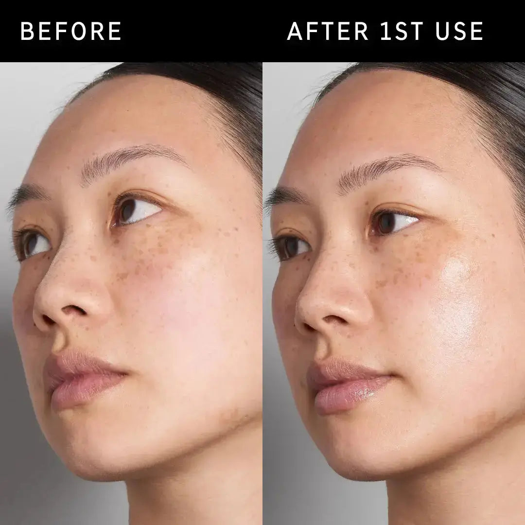 Before and after comparison of The Inkey List Hyaluronic Acid Serum, showing visibly smoother and more hydrated skin after first use.
