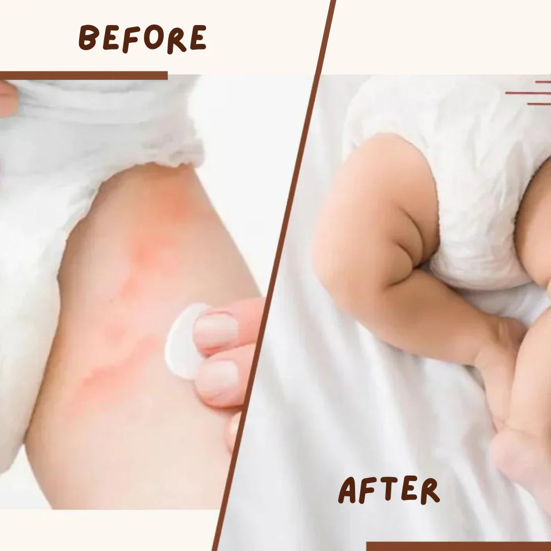 Before and after results of effective nappy rash treatment on baby skin.