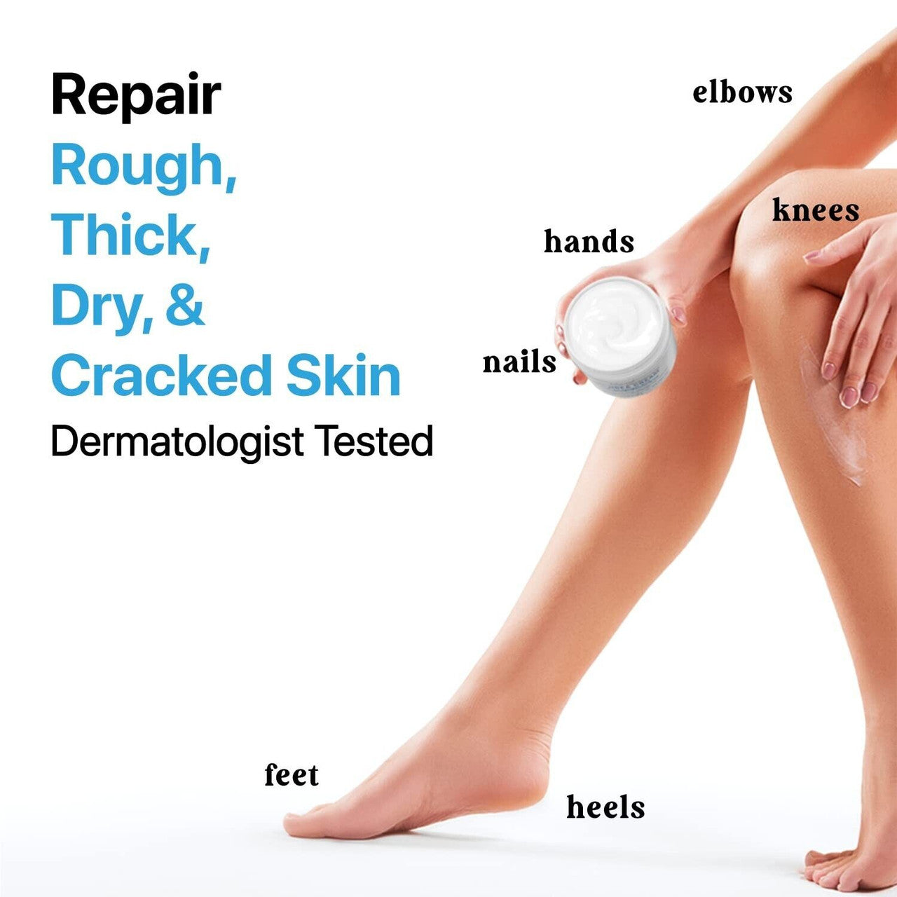 Ebanel Urea Repair Cream 40% with Salicylic Acid applied to legs, targeting rough skin on feet, heels, knees, elbows, and hands. Dermatologist-tested care.