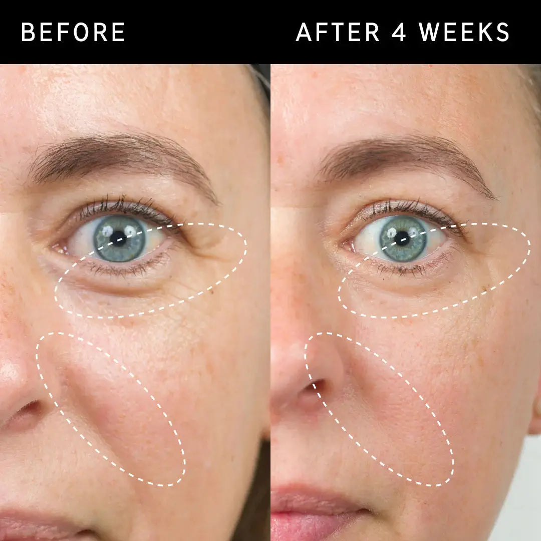 Close-up before and after comparison of a woman's eye area, demonstrating the smoothing and plumping effects of The Inkey List Bio-Active Ceramide Moisturizer after 4 weeks.