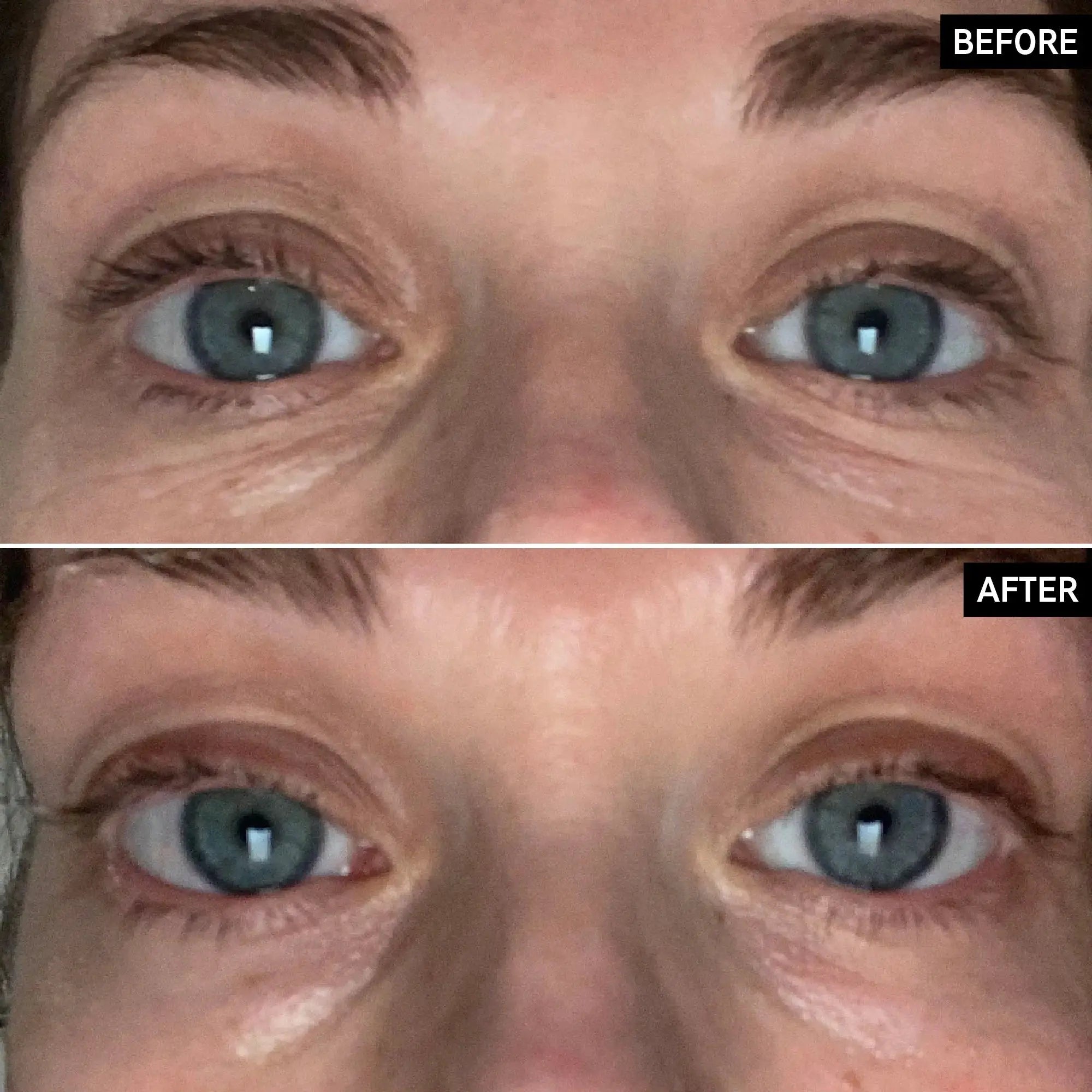 Before and after comparison of under-eye skin using The Inkey List Brightening Eye Cream, showing visible reduction in dark circles and improved brightness.