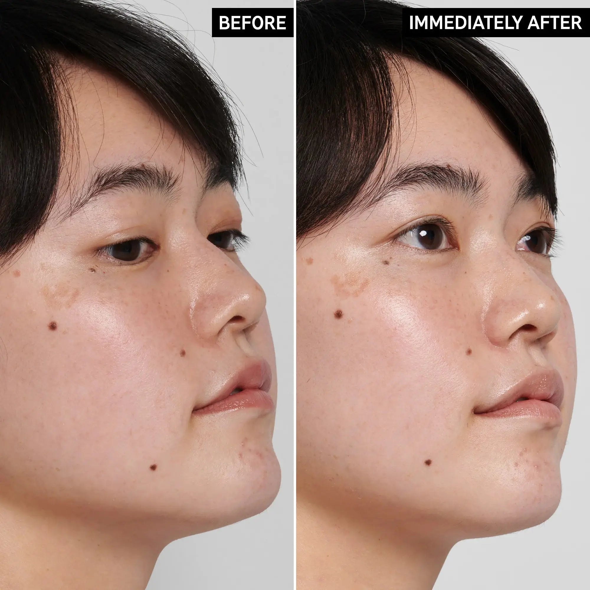 Before and after comparison of a woman's face showing improved skin hydration and smoothness after using The Inkey List Hyaluronic Acid Cleanser.