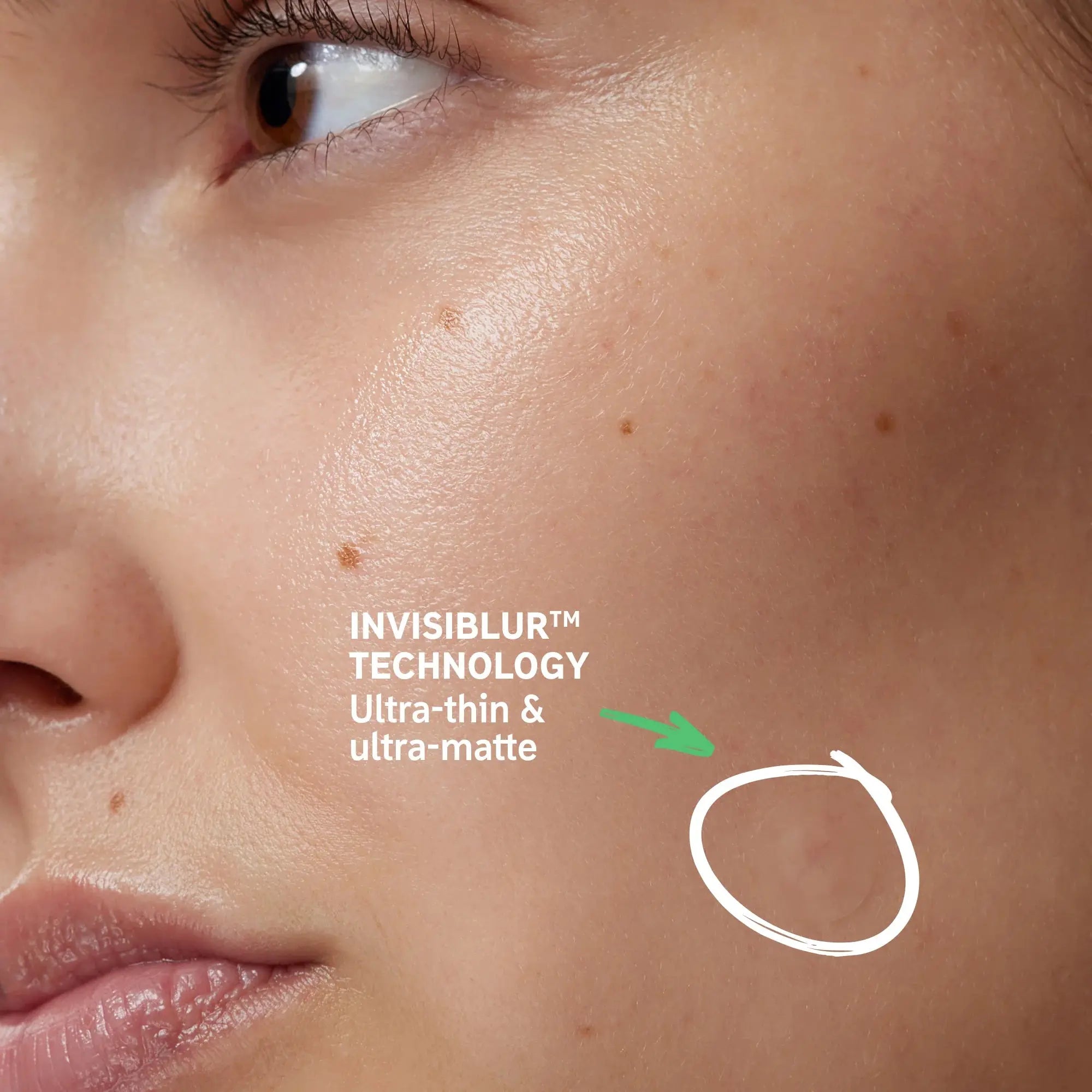 Model wearing The Inkey List Hydrocolloid Invisible Pimple Patch with INVISIBLUR™ technology, showcasing its ultra-thin and matte finish.