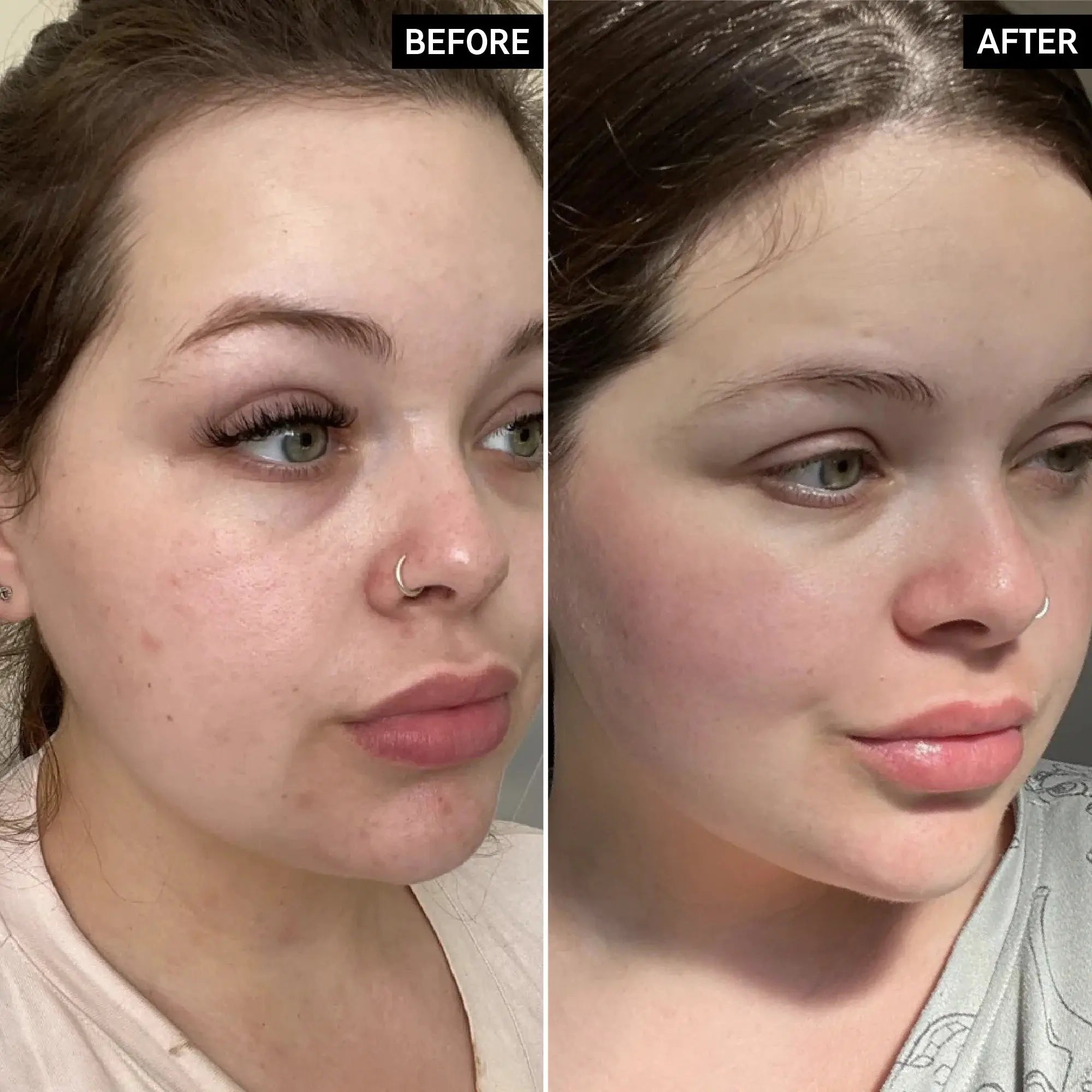 Before and after comparison of a woman using The Inkey List Omega Water Cream, highlighting improved skin texture and hydration benefits.