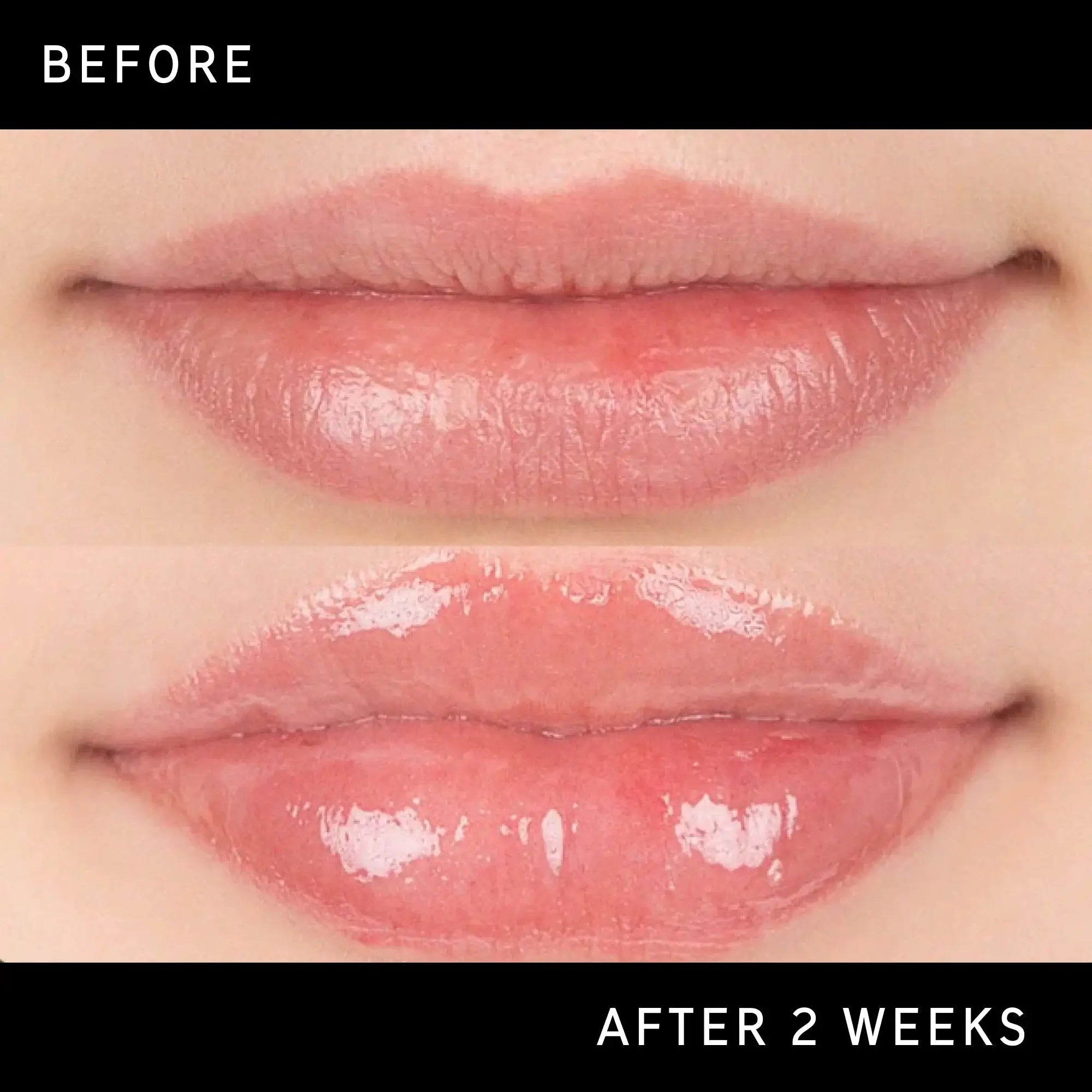 صورة قبل وبعد استخدام مرطب الشفاه The Inkey List Tripeptide Plumping Lip Balm Clear لمدة أسبوعين، تظهر زيادة في حجم الشفاه وترطيبها.