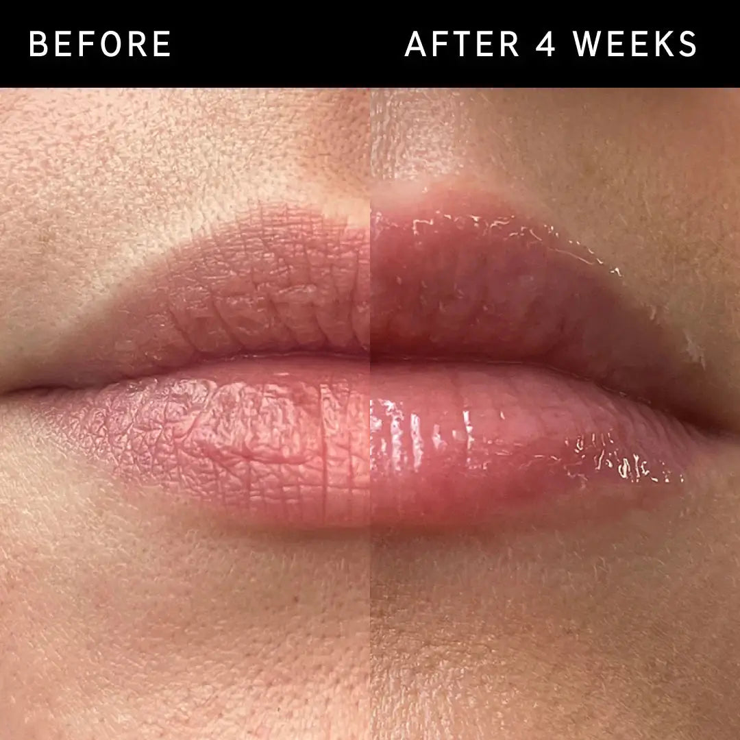 نتائج قبل وبعد 4 أسابيع من استخدام The Inkey List Tripeptide Plumping Lip Balm Clear، حيث تبدو الشفاه أكثر امتلاءً وترطيباً بوضوح.