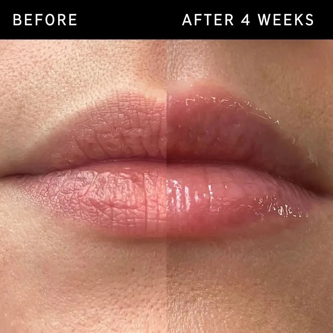 Before and after 4 weeks of using The Inkey List Tripeptide Plumping Lip Balm Pink Tint. Clinically proven to plump lips by up to 40%.